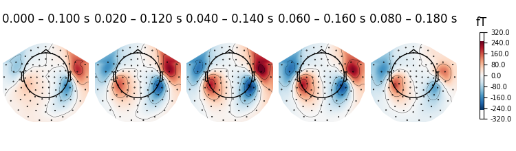 0.000 – 0.100 s, 0.020 – 0.120 s, 0.040 – 0.140 s, 0.060 – 0.160 s, 0.080 – 0.180 s, fT