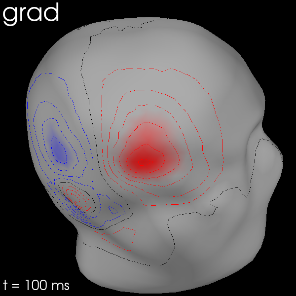 20 visualize evoked