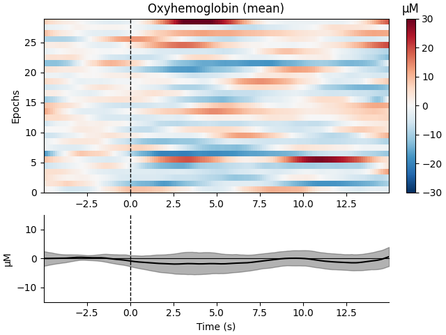 Oxyhemoglobin (mean), µM