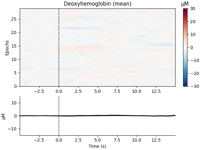 Deoxyhemoglobin (mean), µM