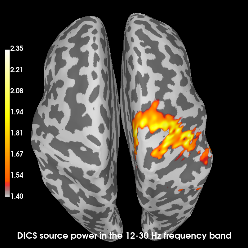 dics source power