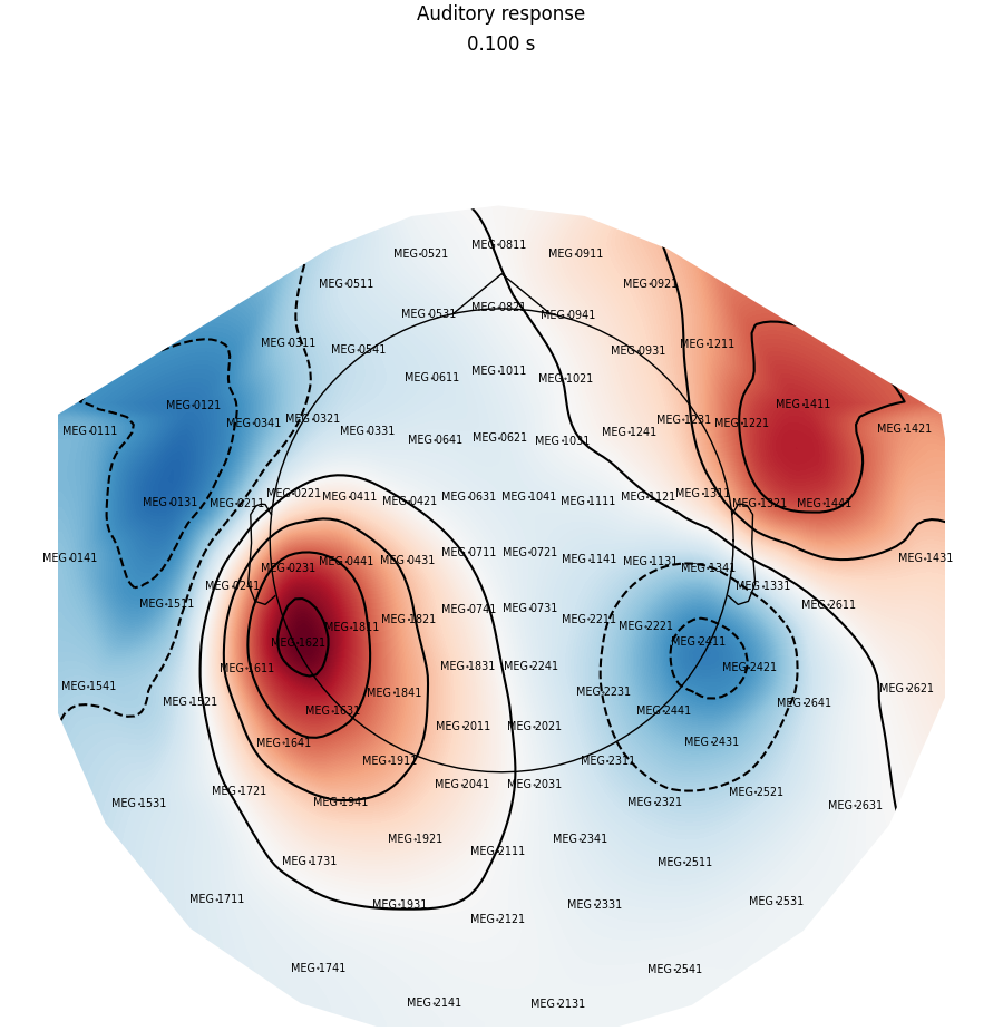 Auditory response, 0.100 s