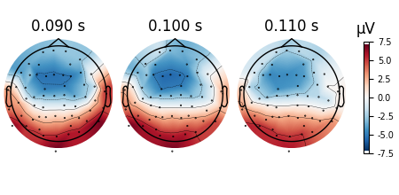 0.090 s, 0.100 s, 0.110 s, µV