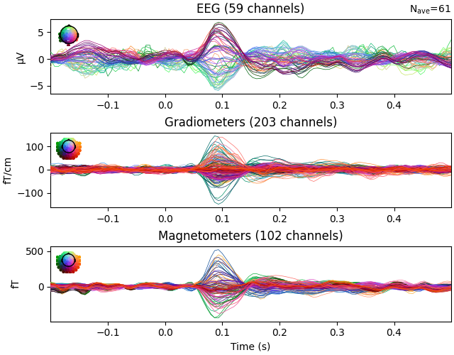 EEG (59 channels), Gradiometers (203 channels), Magnetometers (102 channels)