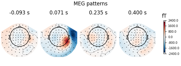 MEG patterns, -0.093 s, 0.071 s, 0.235 s, 0.400 s, fT