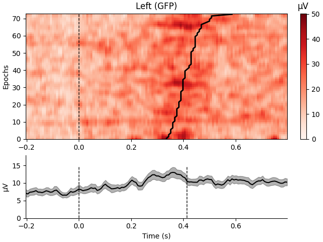 Left (GFP), µV