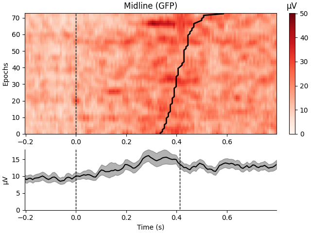 Midline (GFP), µV