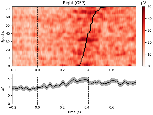 Right (GFP), µV