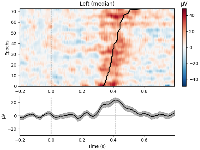 Left (median), µV