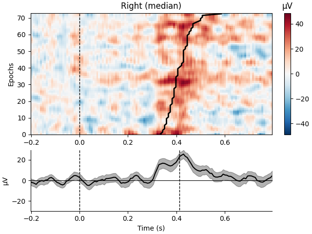 Right (median), µV