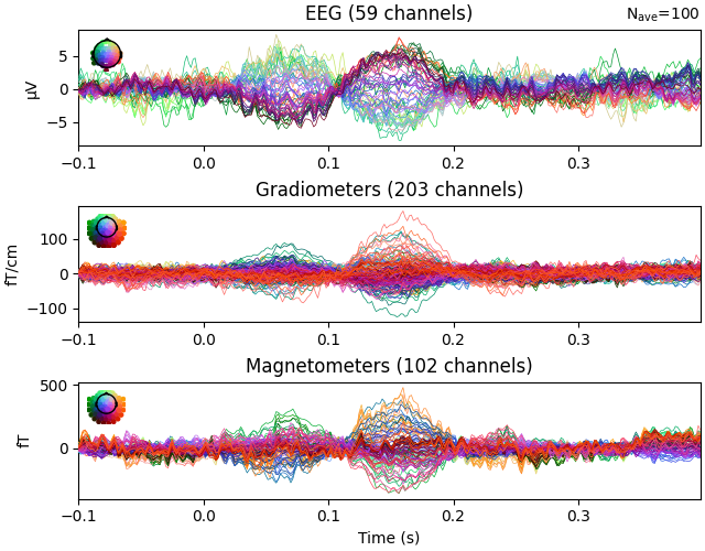 EEG (59 channels), Gradiometers (203 channels), Magnetometers (102 channels)