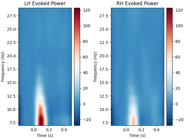 LH Evoked Power, RH Evoked Power