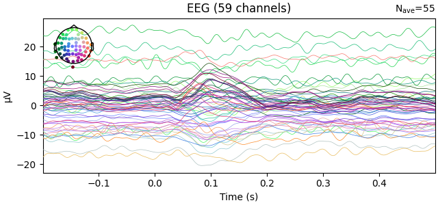 EEG (59 channels)