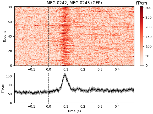 MEG 0242, MEG 0243 (GFP), fT/cm