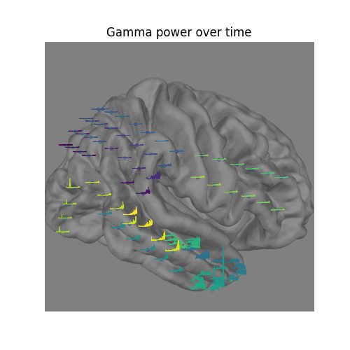 Gamma power over time