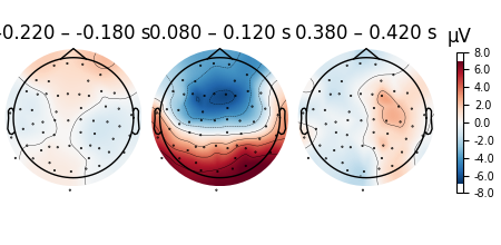 -0.220 – -0.180 s, 0.080 – 0.120 s, 0.380 – 0.420 s, µV