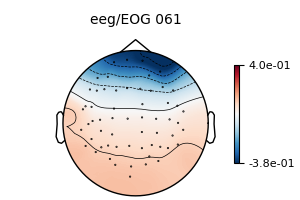 , eeg/EOG 061