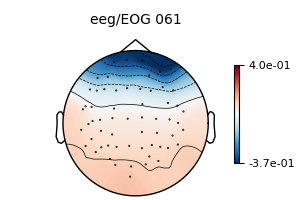 , eeg/EOG 061