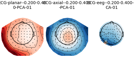 ECG-planar--0.200-0.40 0-PCA-01, ECG-axial--0.200-0.400 -PCA-01, ECG-eeg--0.200-0.400-P CA-01