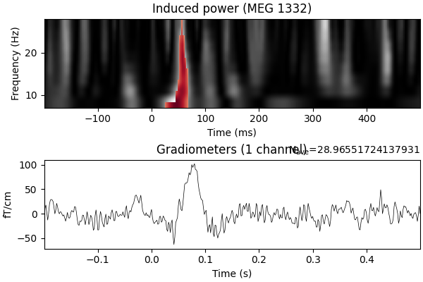 Induced power (MEG 1332), Gradiometers (1 channel)