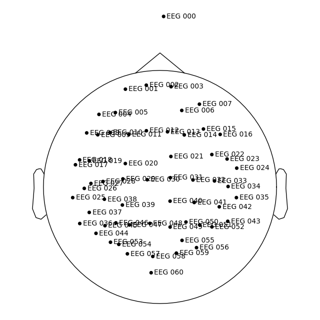 70 eeg mri coords