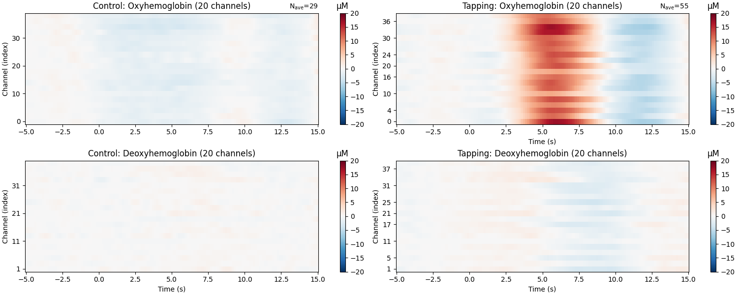 Control: Oxyhemoglobin (20 channels), Tapping: Oxyhemoglobin (20 channels), Control: Deoxyhemoglobin (20 channels), Tapping: Deoxyhemoglobin (20 channels), µM, µM, µM, µM