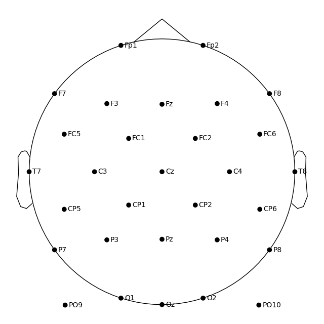 contralateral referencing