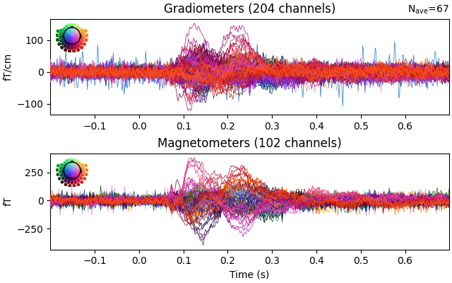 Gradiometers (204 channels), Magnetometers (102 channels)