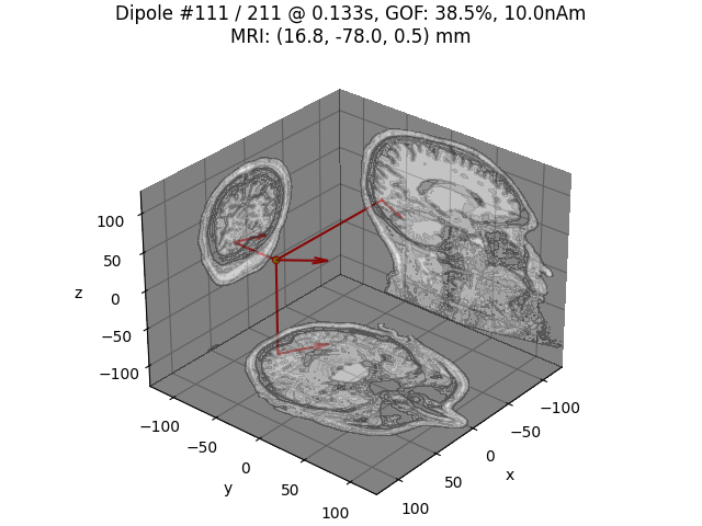 Dipole #111 / 211 @ 0.133s, GOF: 38.5%, 10.0nAm MRI: (16.8, -78.0, 0.5) mm