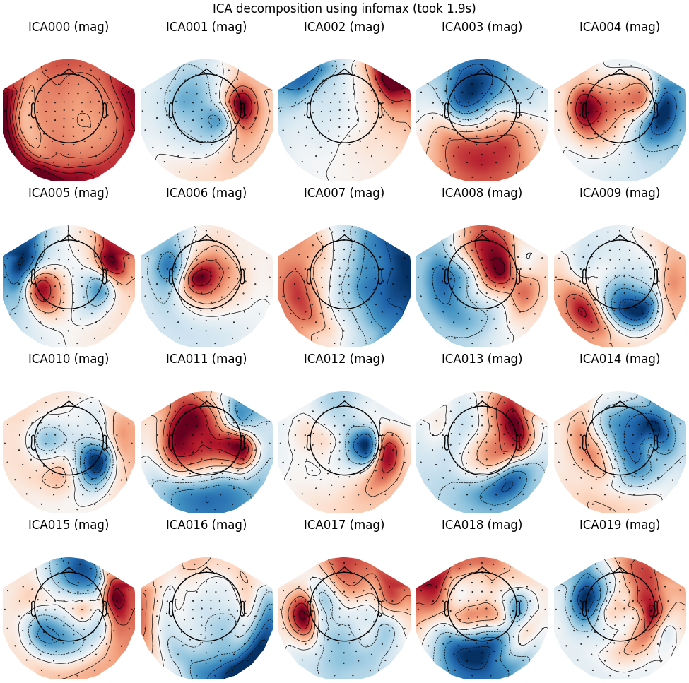 ICA decomposition using infomax (took 1.9s), ICA000 (mag), ICA001 (mag), ICA002 (mag), ICA003 (mag), ICA004 (mag), ICA005 (mag), ICA006 (mag), ICA007 (mag), ICA008 (mag), ICA009 (mag), ICA010 (mag), ICA011 (mag), ICA012 (mag), ICA013 (mag), ICA014 (mag), ICA015 (mag), ICA016 (mag), ICA017 (mag), ICA018 (mag), ICA019 (mag)