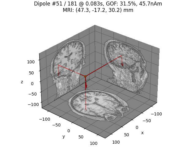 Dipole #51 / 181 @ 0.083s, GOF: 31.5%, 45.7nAm MRI: (47.3, -17.2, 30.2) mm