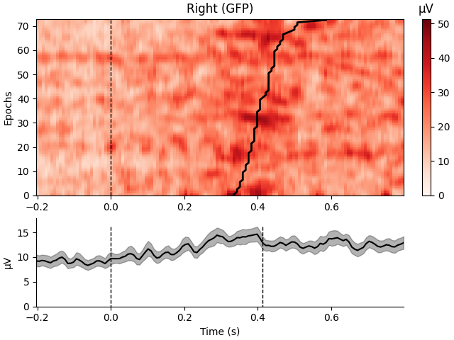 Right (GFP), µV