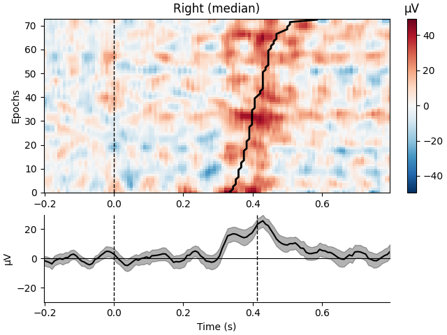 Right (median), µV