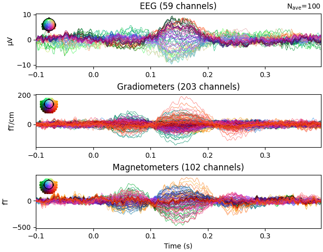 EEG (59 channels), Gradiometers (203 channels), Magnetometers (102 channels)