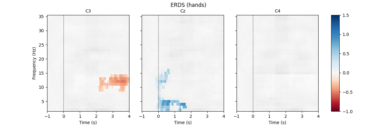 ERDS (hands), C3, Cz, C4