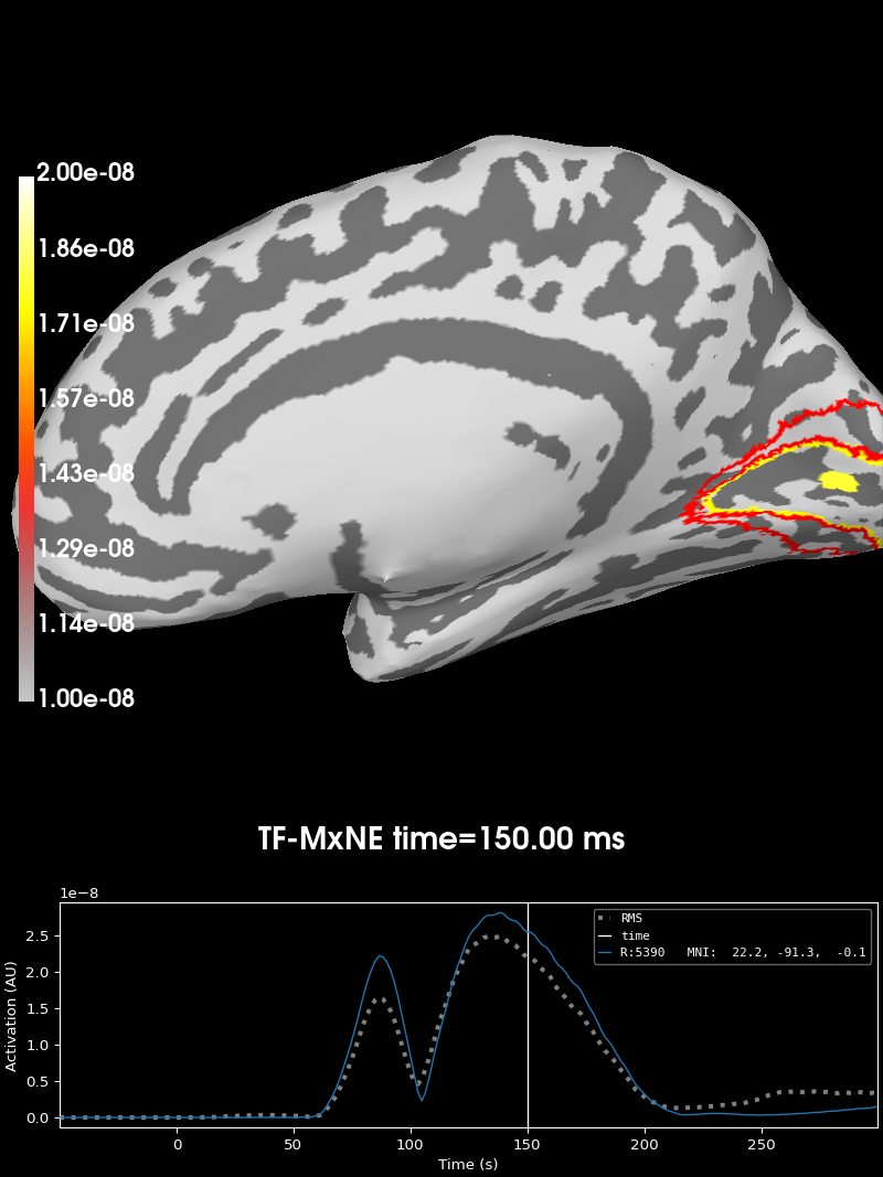 time frequency mixed norm inverse