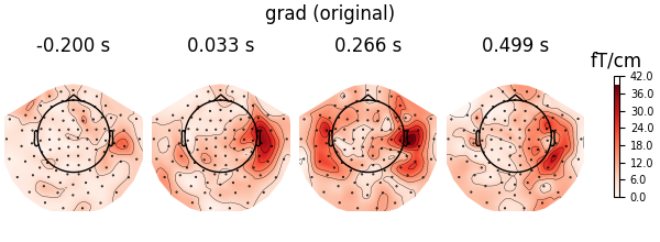 grad (original), -0.200 s, 0.033 s, 0.266 s, 0.499 s, fT/cm