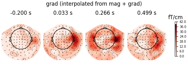 grad (interpolated from mag + grad), -0.200 s, 0.033 s, 0.266 s, 0.499 s, fT/cm