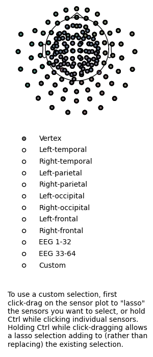 20 visualize epochs