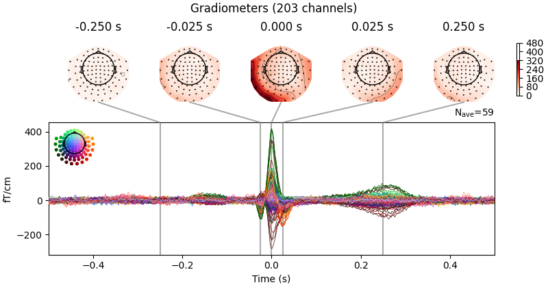 Gradiometers (203 channels), -0.250 s, -0.025 s, 0.000 s, 0.025 s, 0.250 s
