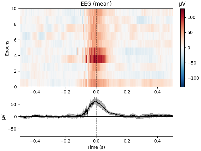 EEG (mean), µV