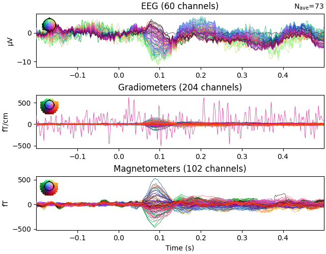 EEG (60 channels), Gradiometers (204 channels), Magnetometers (102 channels)