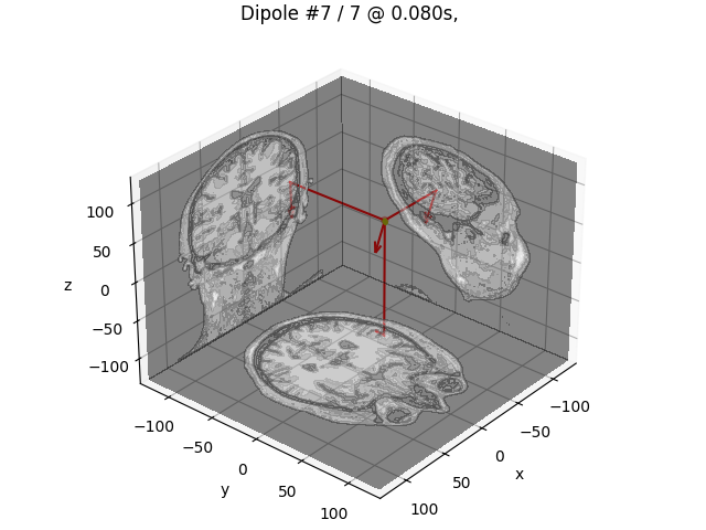 Dipole #7 / 7 @ 0.080s, GOF: 56.9%, 39.6nAm MRI: (-56.9, -19.7, 26.0) mm