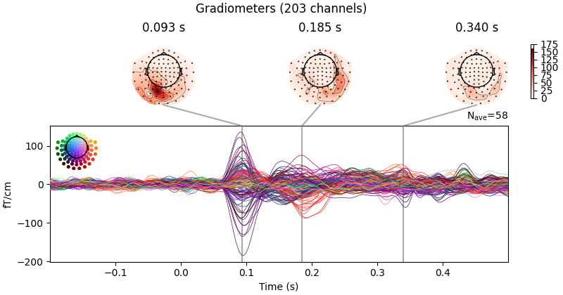 Gradiometers (203 channels), 0.093 s, 0.185 s, 0.340 s