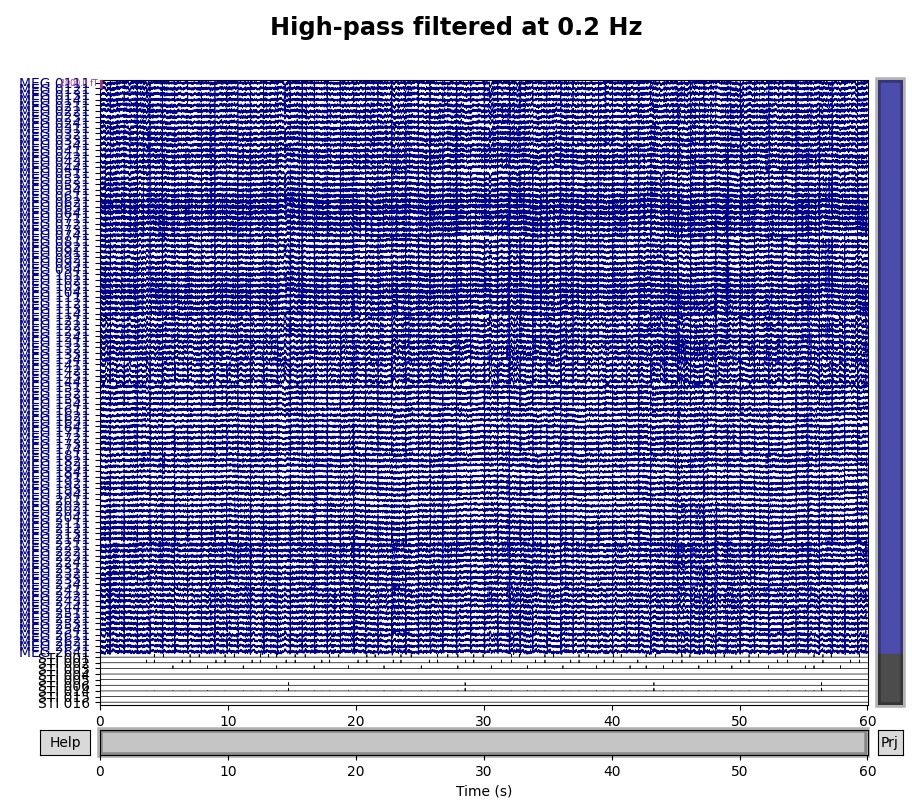 High-pass filtered at 0.2 Hz