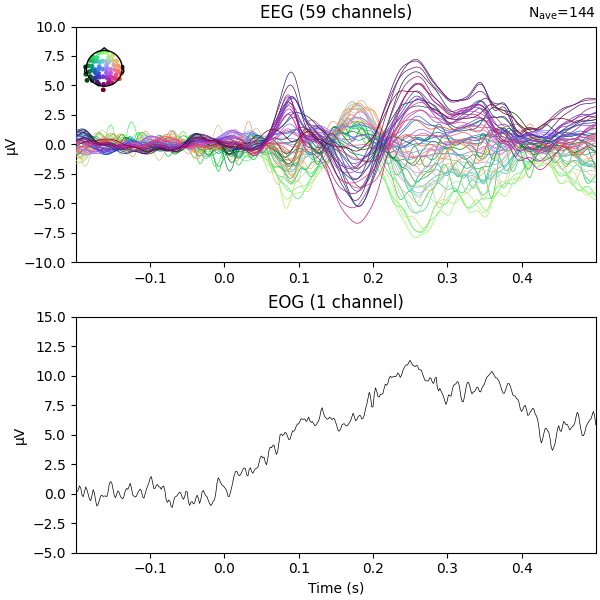 Auditory epochs, Magnetometers (270 channels), EOG (2 channels)