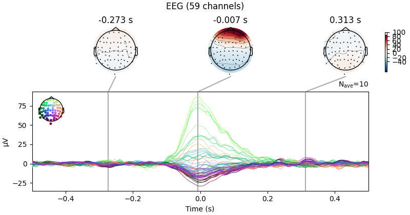 EEG (59 channels), -0.273 s, -0.007 s, 0.313 s