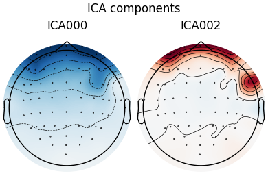 ICA components, ICA000, ICA002