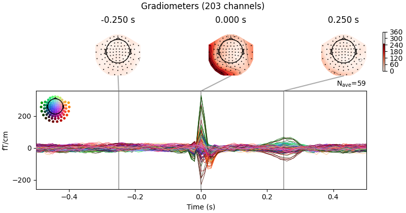 Gradiometers (203 channels), -0.250 s, 0.000 s, 0.250 s