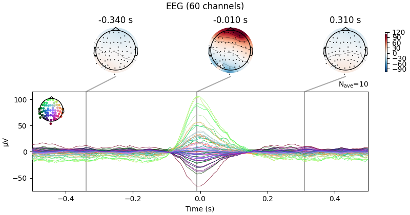EEG (60 channels), -0.340 s, -0.010 s, 0.310 s